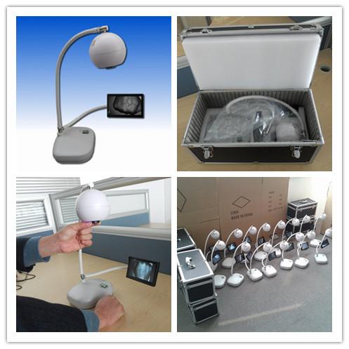 Lamp To Display Veins Vein Locator Device Improves Staff Efficiency