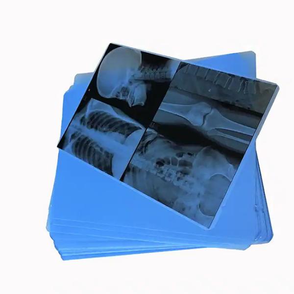 Discover 125 Micron Semi - Transparent White Laser Medical X - Ray PET Plastic Films For Medical Applications