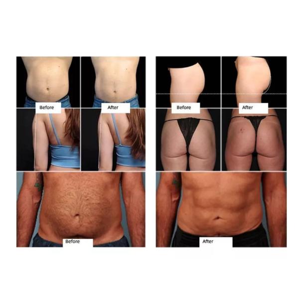 Черная уменьшая мышца машины 3000W Ems красоты строит тело  контуря двойные ручки