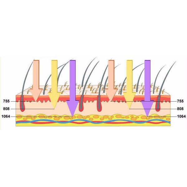 Машина удаления волос депиляции 808nm диода оборудования красоты лазера подмолаживания кожи