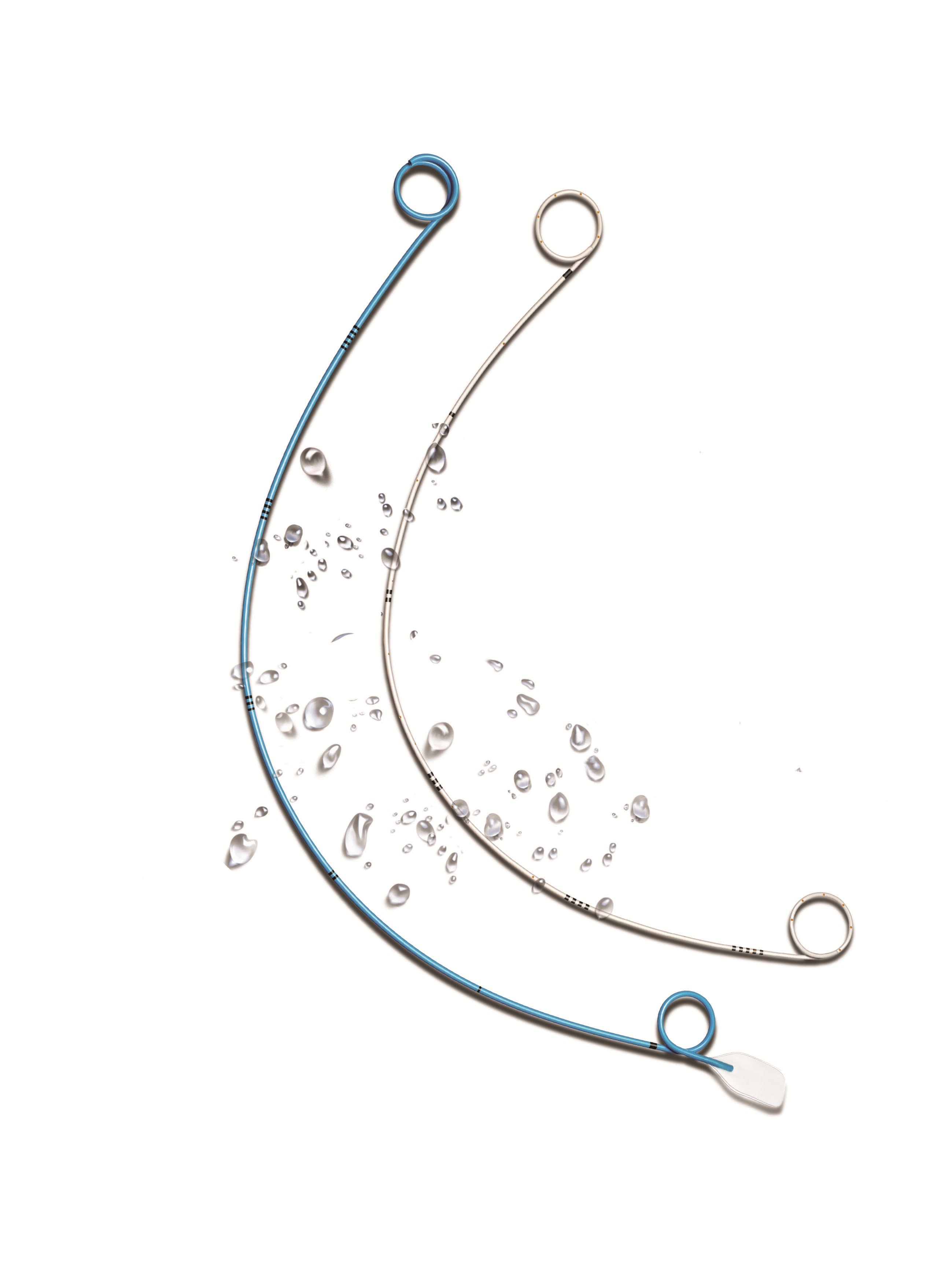 Antireflux Double-J Ureteral Stent with Hydrophilic Coating and Large Lumen