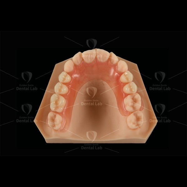 Medical Grade Valplast Partial Denture Valplast Dental Lab Metal Free