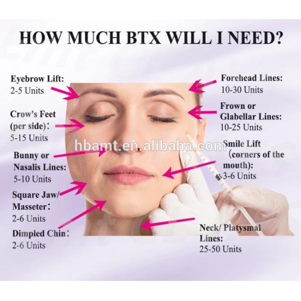 Tipo antienvelhecimento da toxina Botulinum de 100 unidades injeções de uma BTX