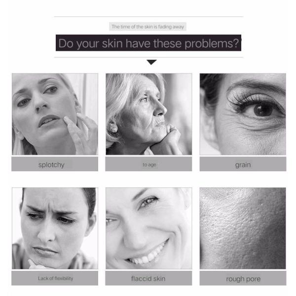 3D High Intensity Focused Ultrasound Face Lift Machine For Double Chin