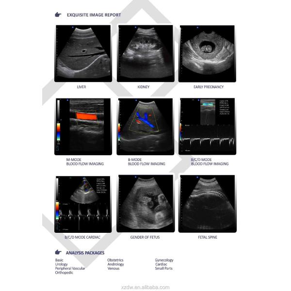 GH-L5 Portable Ultrasound Machine  4d Diagnostic Ultrasound Pregnancy Machine