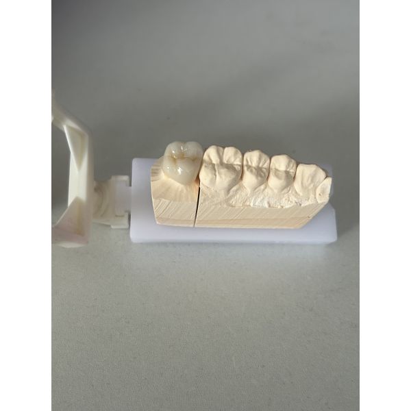 High Strength 1200 MPa Zirconia Crown with Excellent Biocompatibility and Long-lasting Durability for Dental Restoration
