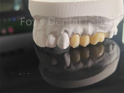 High Strength  Full Porcelain Layered Zirconia For Dental Crowns