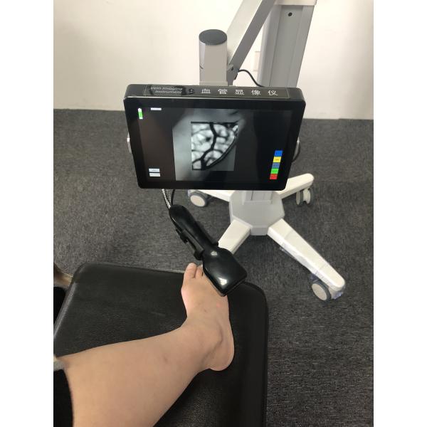 Safe Portable Infrared Vein Locator Device Vein Scanner Screen Displayed