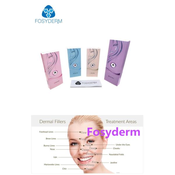 2ml Hyaluronic Acid Gel Injections Surgical Rhinoplasty