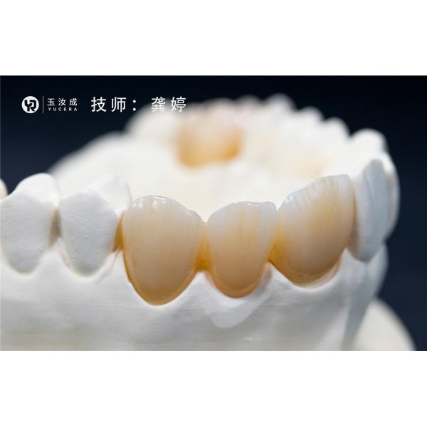 O auto Multilayer do disco da zircônia da estética coloriu 3D pro CFDA para 1500℃