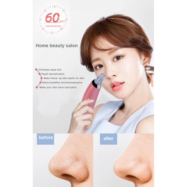 DC 5V Electric Pore Cleanser Blackhead & Acne Remover Rechargeable 2600MAH Battery