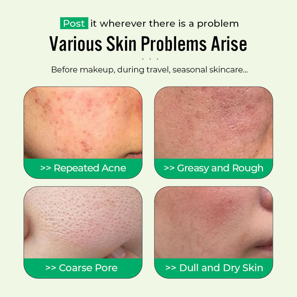 OEM ODM skin care product cleaning pad Soothing, moisturizing, oil control, toner pad, moisturizing and moisturizing facial mask pad