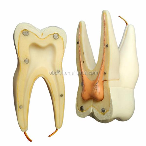 Dental Care Demonstration Detachable Anatomical Teeth Model for Three-Root Molar Teeth
