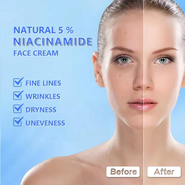 Nicotinamide Organic Face Cream Arbutin Night Bleaching Skin Lightening Cream For Dark Skin