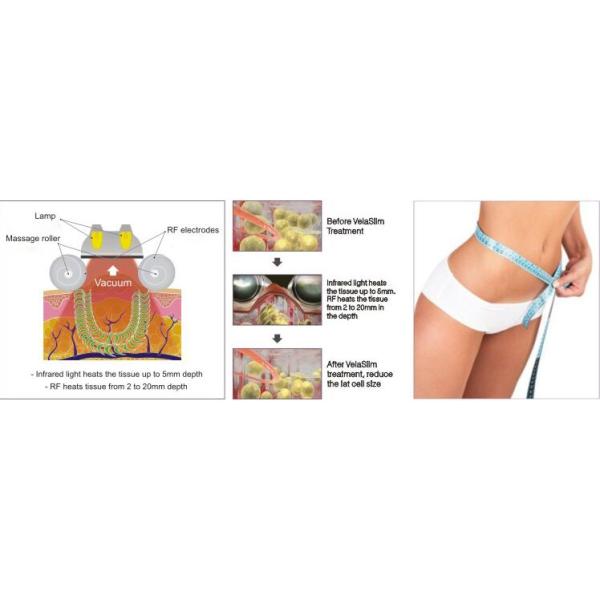 вакуумируйте Вела длинноволновой части инфракрасной области массажа ролика РФ липосакции машины потери веса двухполярные