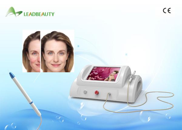 30MHz RBS high frequency portable vessels vein wave vascular spider vein