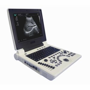 Машина ультразвука Doppler цвета OB GYN портативная в беременности