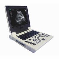 Máquina portátil do ultrassom de Doppler da cor de OB GYN na gravidez