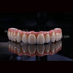 Titanium Abutment Dental Implant Screw Retained Crown 3D Laser Printing Customized