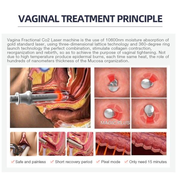 Wrinkle Removal CO2 Fractional Laser Machine Portable 4D Facial Beauty Spa Equipment