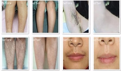 Personal Mini IPL Hair Removal Machines For Hair Removal / Skin Rejuvenation