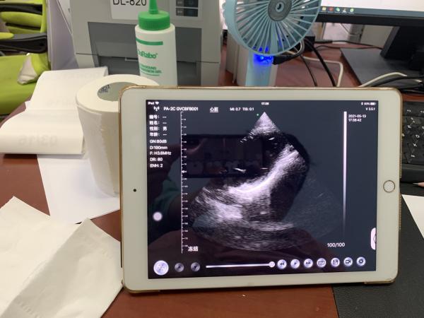 Wireless Phased Array Ultrasound Transducer Handheld Cardiac Echography Wireless Ultrasound Probe Price for Sale