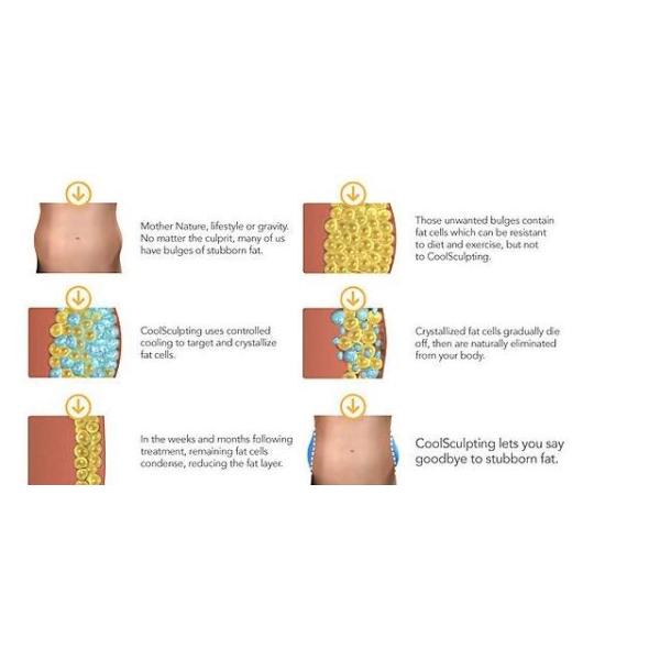 4 Cryo Handles Body Slimming Machine , Vertical Type Weight Reduction Equipment