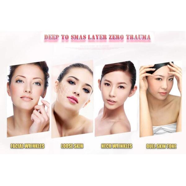 USA 5th Generation HIFU Facelift Machine , High Performance HIFU Beauty Machine