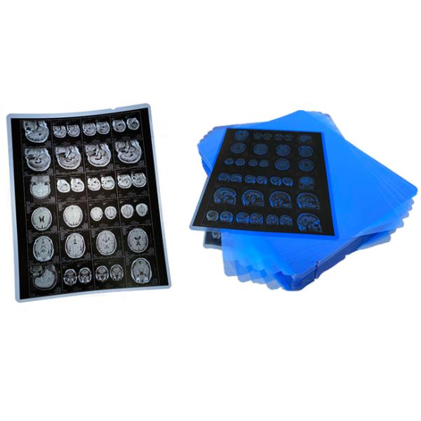 Фильм воображения радиологии фильма листа основания кс Рэй ЛЮБИМЦА для листов ДР КТ 100 в пакет