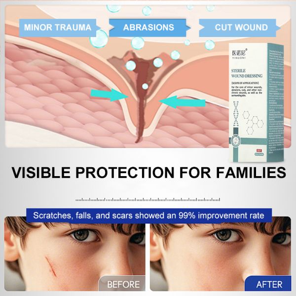 Washable Wound Care Spray 20ml Sterile Wound Dressing Spray For Abrasions Or Cuts