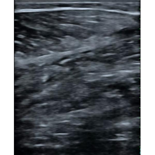 Veterinary Ultrasound System Bovine Ultrasound Machine 4.0MHz 6.0MHz 8.0MHz