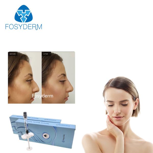 A cruz de Fosyderm ligou a linha profunda enchimento cutâneo do enchimento 2ml para o nariz acima