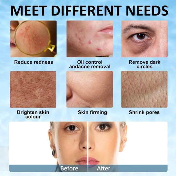 Rouleau de glace en silicone pour le visage – Masseur facial réutilisable pour thérapie par le froid contre les poches, l'acné, les rougeurs et le raffermissement de la peau | Outil de soin de la peau sans BPA pour femmes, hommes, peaux sensibles et routine de beauté quotidienne