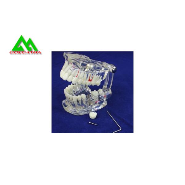 PVC Plastic Soft Gum Teeth Model , Dental Models For Teaching CE ISO