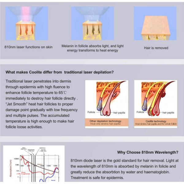 удаление волос лазера для машины удаления волос лазера светлых волос личной