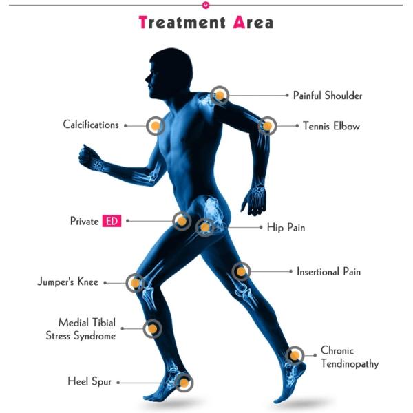 2-16hz Extracorporeal Shock Wave Therapy Machine Physical ED Therapy Pain Relief
