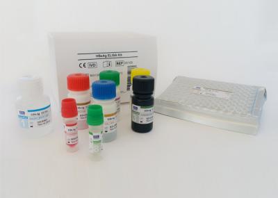 Immunoassay da enzima do sanduíche de Elisa do jogo do teste de HBsAg do certificado do PBF para o ser humano