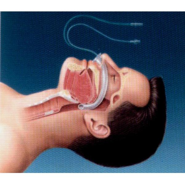 ID 4.0-9.0mm ORCL трубки авиалинии носа авиалинии Npa больницы носоглоточный