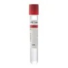 Siny Medical Advanced Platelet-Rich Fibrin a Prf Tubes
