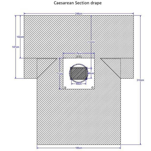 Absorbent Reinforced 40g - 60g SP / SMS / SMMS / SMMMS C-Section Surgical Drape For Caesarean Section With Collection