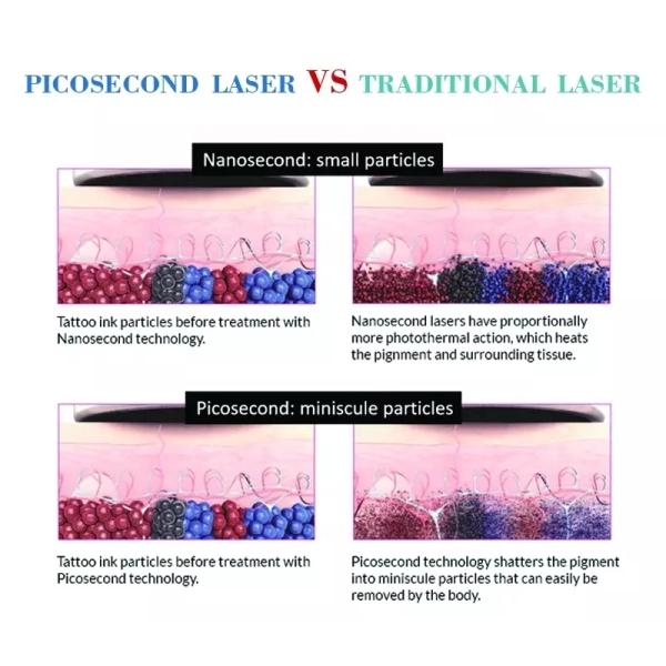 Picosecond Laser Tattoo Removal Machine Light Guiding Arm 7 Joints 1064nm