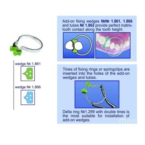 TOR VM Dental Add-on Wedges 1.870 MFDS Certified Delta Rings Kit for Dental Fixing and Teeth Restoration