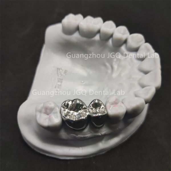 China Dental Lab Dental Full Metal Crown Customized 3D Printing