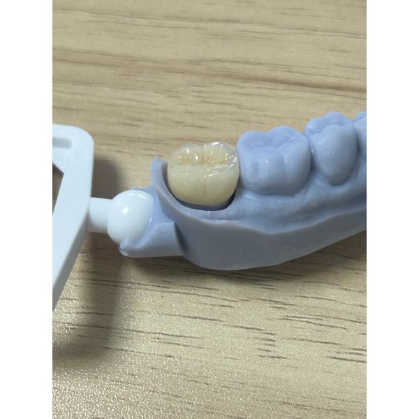 Full Zirconia Crown - High Strength Biocompatible Dental Crown for Durability