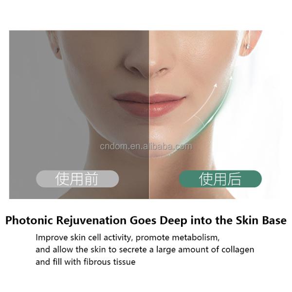 Double Chin Reducer and EMS Ion Technology for V-Shaping Face Lift in Portable Design