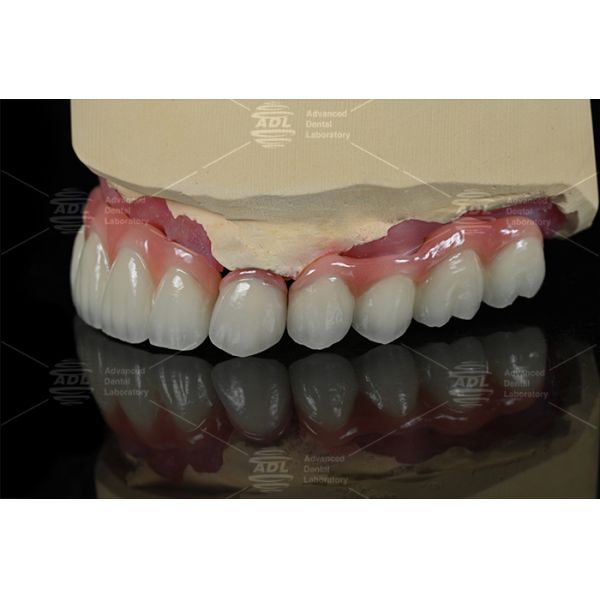 Hypoallergenic PFZ dental solutions tailored to meet diverse clinical and dental lab needs services ensuring precision