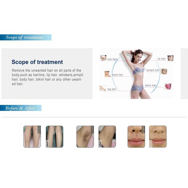 808 diode laser hair removal machine FDA approved laser hair removal machine