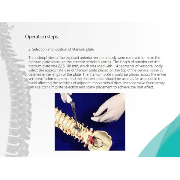 Spine Anterior Cervical Plate Titanium Cervical Plate Implant Orthopedic Surgery CE Certification
