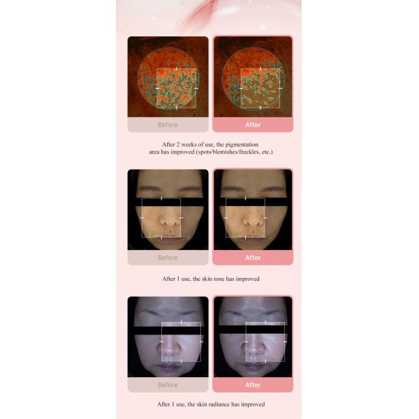 Custom Private Label Microneedling Needles Skin Care Microneedling Skincare Pdrn Peptide Salmon Dna Serum Face Lotion