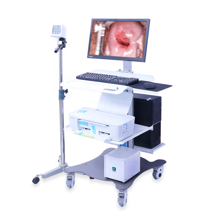 Portable GYN Colposcope Full Hd Sony Camera Digital Video Colposcope Imaging System Examination Colposcope For Gynecology